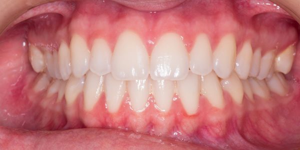 stomatolog, dentysta