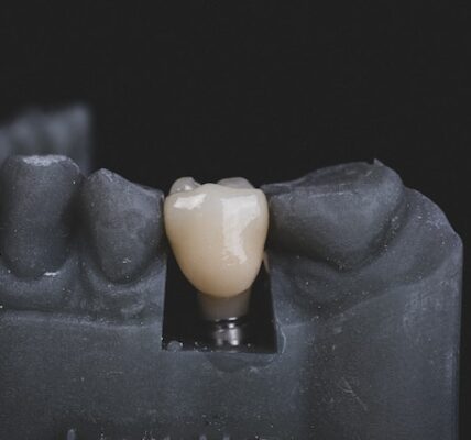 dobór implantów do swoich zębów