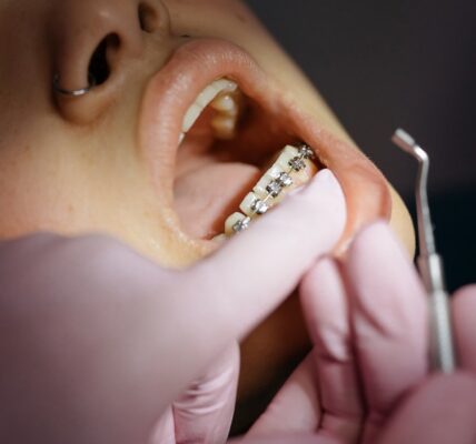 działanie aparatu ortodontycznego
