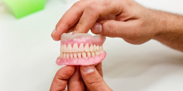 Proteza overdenture