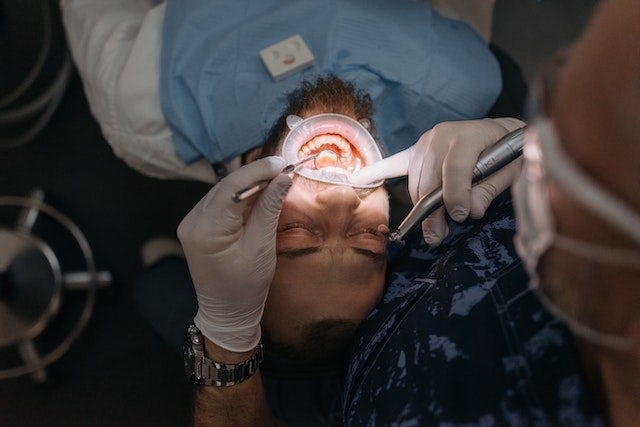 bonding zębów