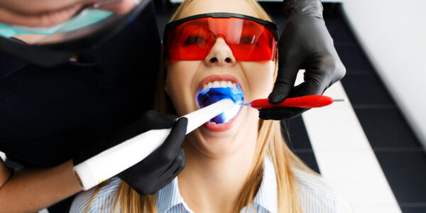 zalecenia przed wybielaniem zębów