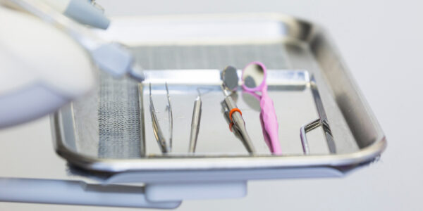 Paradontoza – jak rozpoznać objawy i kiedy iść do dentysty?