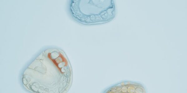 Proteza na dwóch implantach – na czym polega to rozwiązanie?