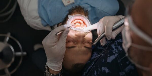 Lakowanie, a lakierowanie zębów - jakie są różnice?